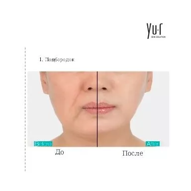 Yu-r Лифтинг комплекс для лица, 3D эффект (гель+10 масок) - Thread Lifting Mask  фото 3