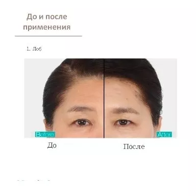 Yu-r Лифтинг комплекс для лица, 3D эффект (гель+10 масок) - Thread Lifting Mask  фото 4